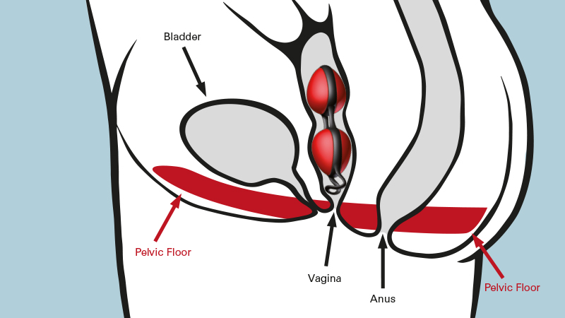 Applicazione palline vaginali